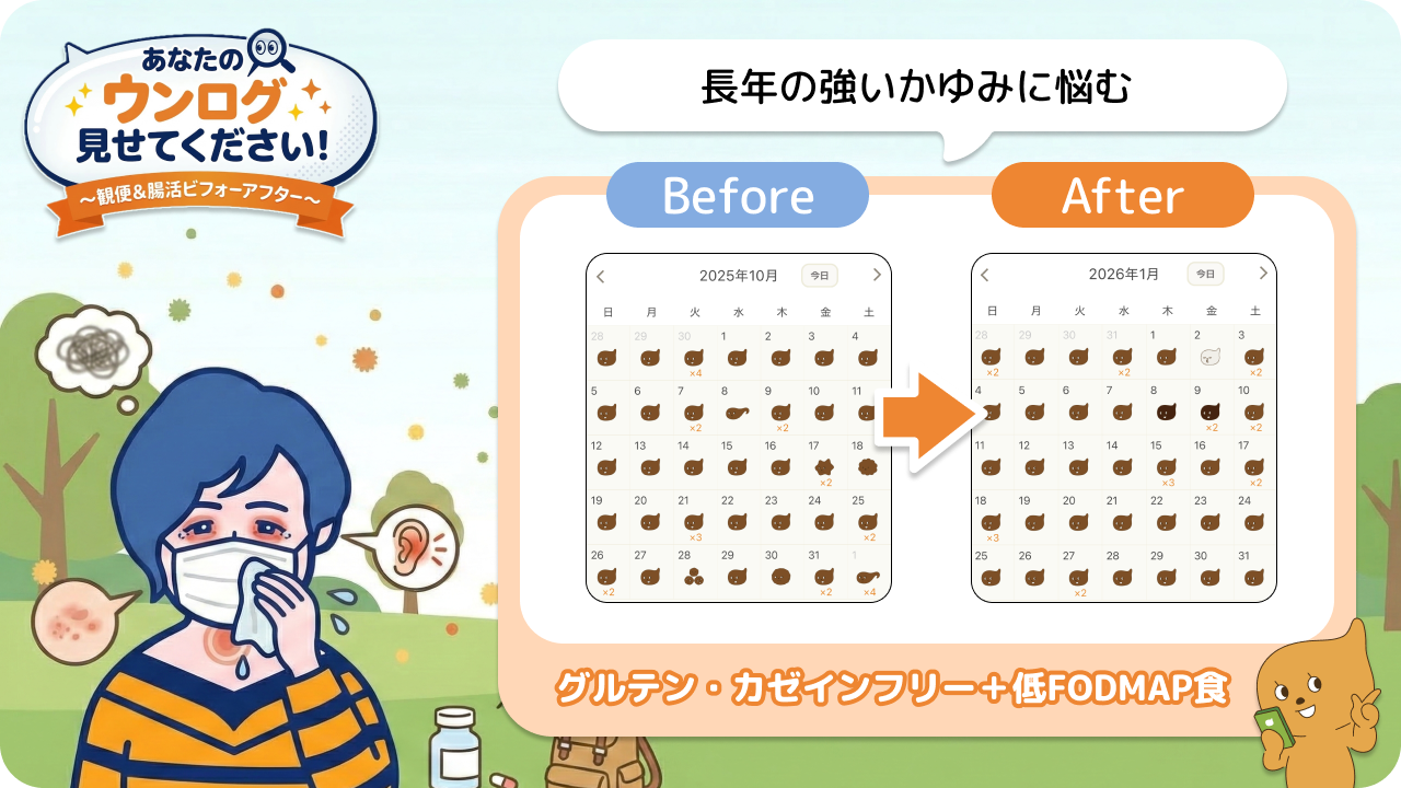 「あなたのウンログ見せてください」vol.12！“引き算の考え方”で花粉症改善した方